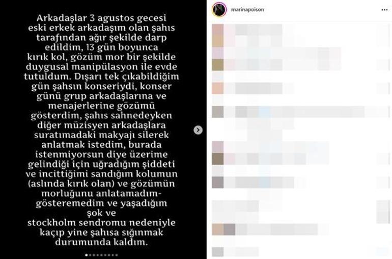 'Yüzyüzeyken Konuşuruz'un üyesi Can Tunaboylu'nun eski sevgilisinden darp iddiası!