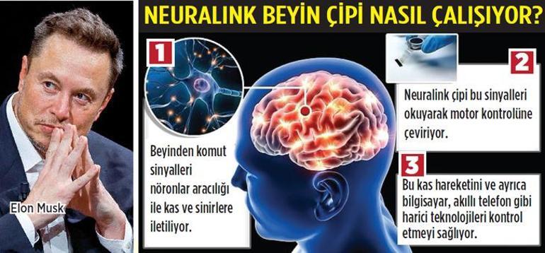 İnsana çip taktı kontrolü ele aldı! ‘Süper insana doğru ilk adım’